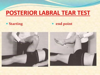 Labral Compression Test Examination of hip joint | PPTX
