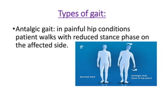EXAMINATION OF HIP JOINT and its management by dr shubham kumar | PDF