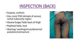 EXAMINATION OF HIP JOINT and its management by dr shubham kumar | PDF