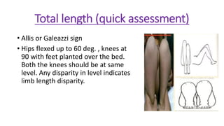 EXAMINATION OF HIP JOINT and its management by dr shubham kumar | PDF