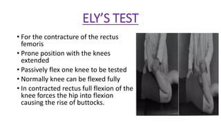 Eli Test EXAMINATION OF HIP JOINT and its management by dr shubham kumar | PDF