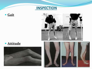 INSPECTION
 Gait
 Attitude
 