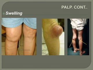 Swelling
 
