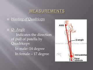  Wasting of Quadriceps
 Q- Angle
Indicates the direction
of pull of patella by
Quadriceps
In male- 14 degree
In female – 17 degree
 