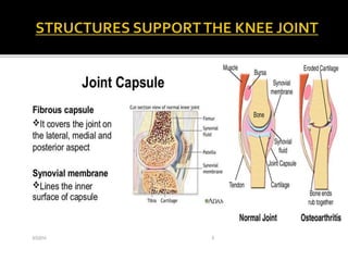  JOINT CAPSULE
 