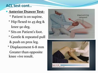 ACL test cont..
 Anterior Drawer Test-
* Patient is on supine.
* Hip flexed to 45 deg &
knee 90 deg.
* Sits on Patient’s foot.
* Gentle & repeated pull
& push on prox leg.
* Displacement 6-8 mm
Greater than opposite
knee +ive result.
 