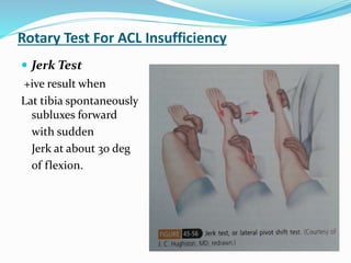 Rotary Test For ACL Insufficiency
 Jerk Test
+ive result when
Lat tibia spontaneously usly
subluxes forward
with sudden
Jerk at about 30 deg
of flexion.
 