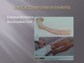External Rotation
Recurvatum Test
 