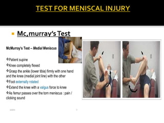 Mc,murray’sTest
 