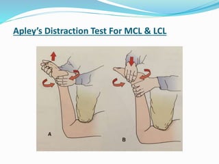 Apley’s Distraction Test For MCL & LCL
 