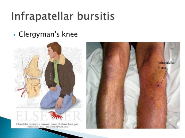 Examination Of Knee Psmc examination-of-knee-psmc