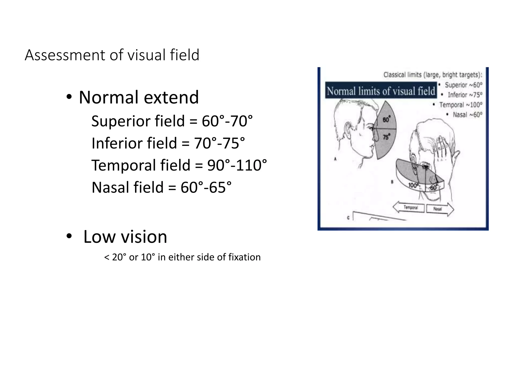Assessment of visual field
• Normal extend
Superior field = 60°-70°
Inferior field = 70°-75°
Temporal field = 90°-110°
Nasal field = 60°-65°
• Low vision
< 20° or 10° in either side of fixation
 