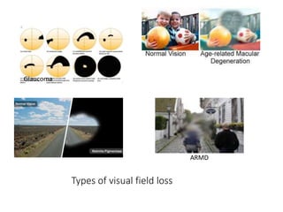 Examination of low vision patient | PPTX