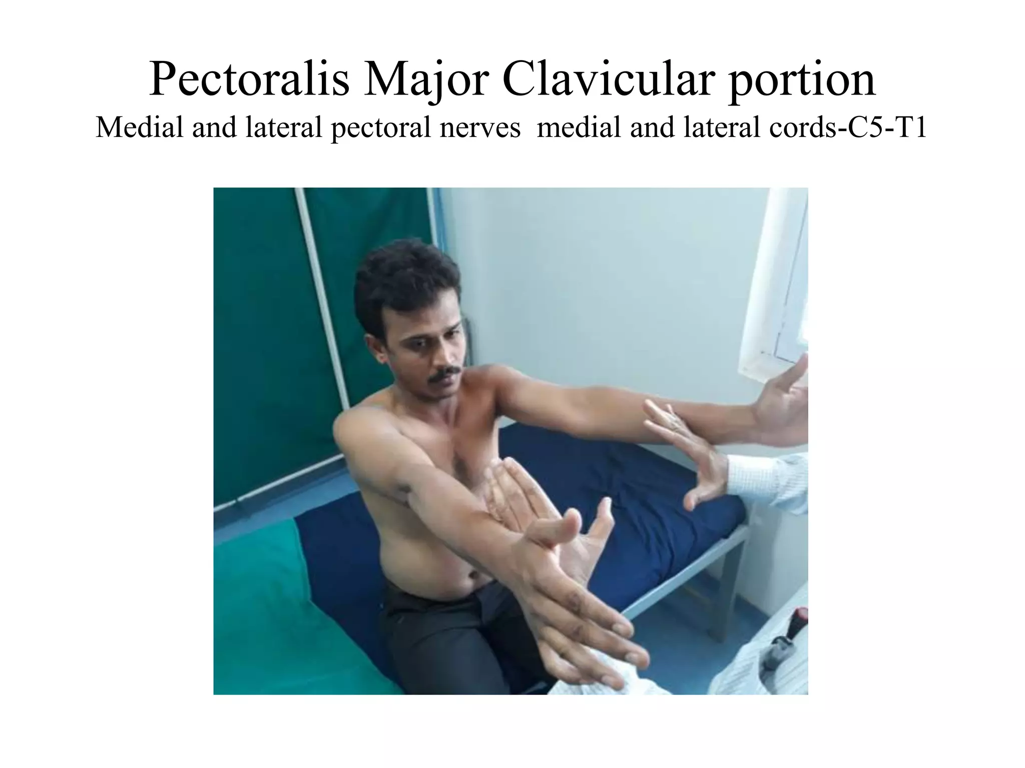 Pectoralis Major Clavicular portion
Medial and lateral pectoral nerves medial and lateral cords-C5-T1
 