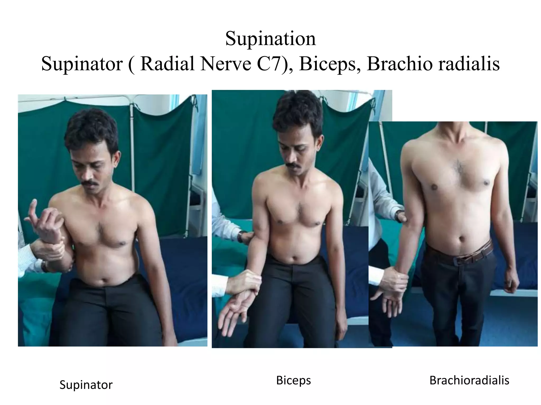 Supination
Supinator ( Radial Nerve C7), Biceps, Brachio radialis
Supinator Biceps Brachioradialis
 