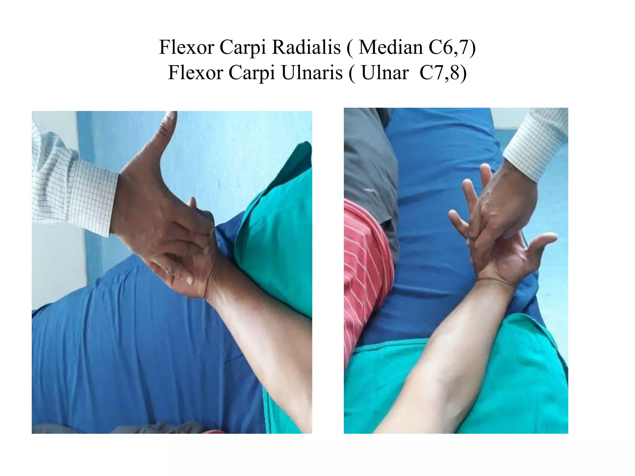 Flexor Carpi Radialis ( Median C6,7)
Flexor Carpi Ulnaris ( Ulnar C7,8)
 