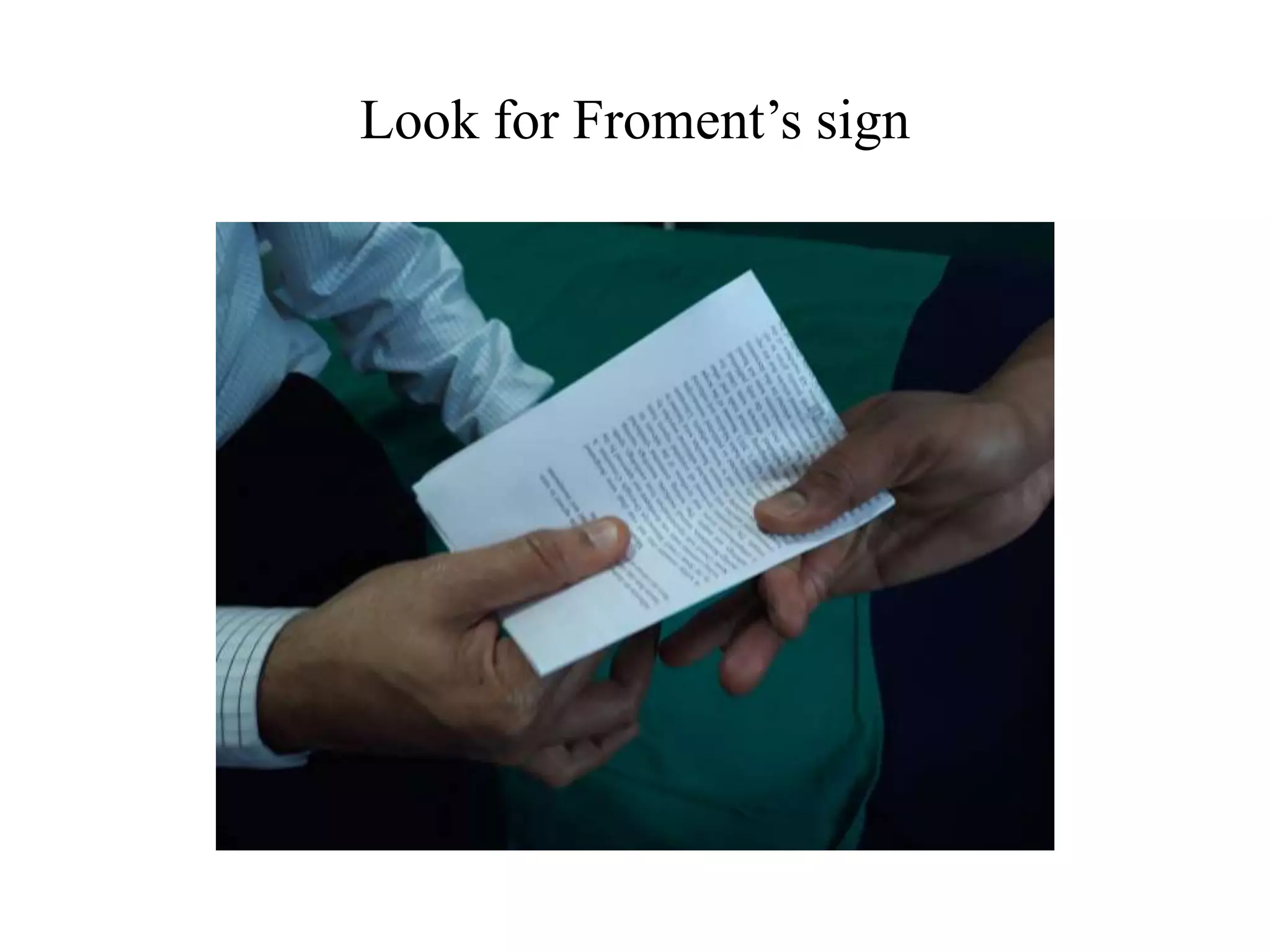 Look for Froment’s sign
 