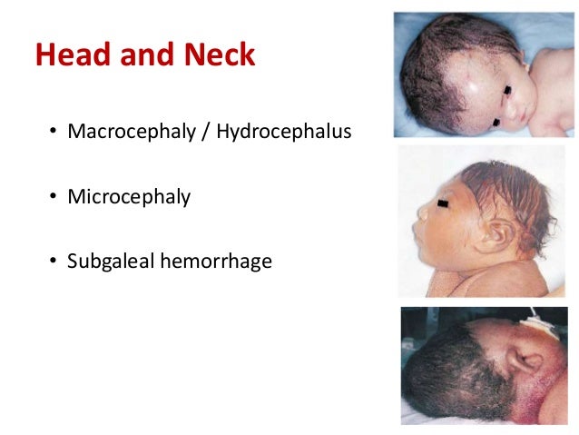 Why Is A Neonate’s Head More “moldable”? Examination of newborn.