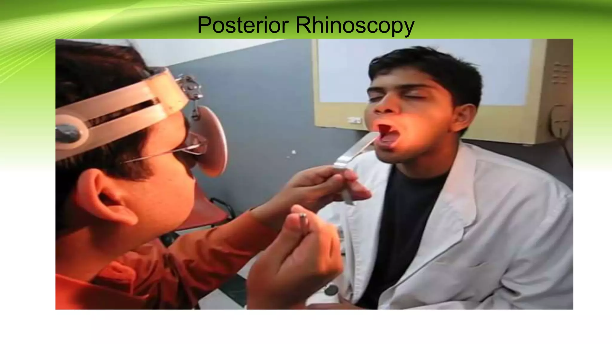 Examination of nose | PPTX