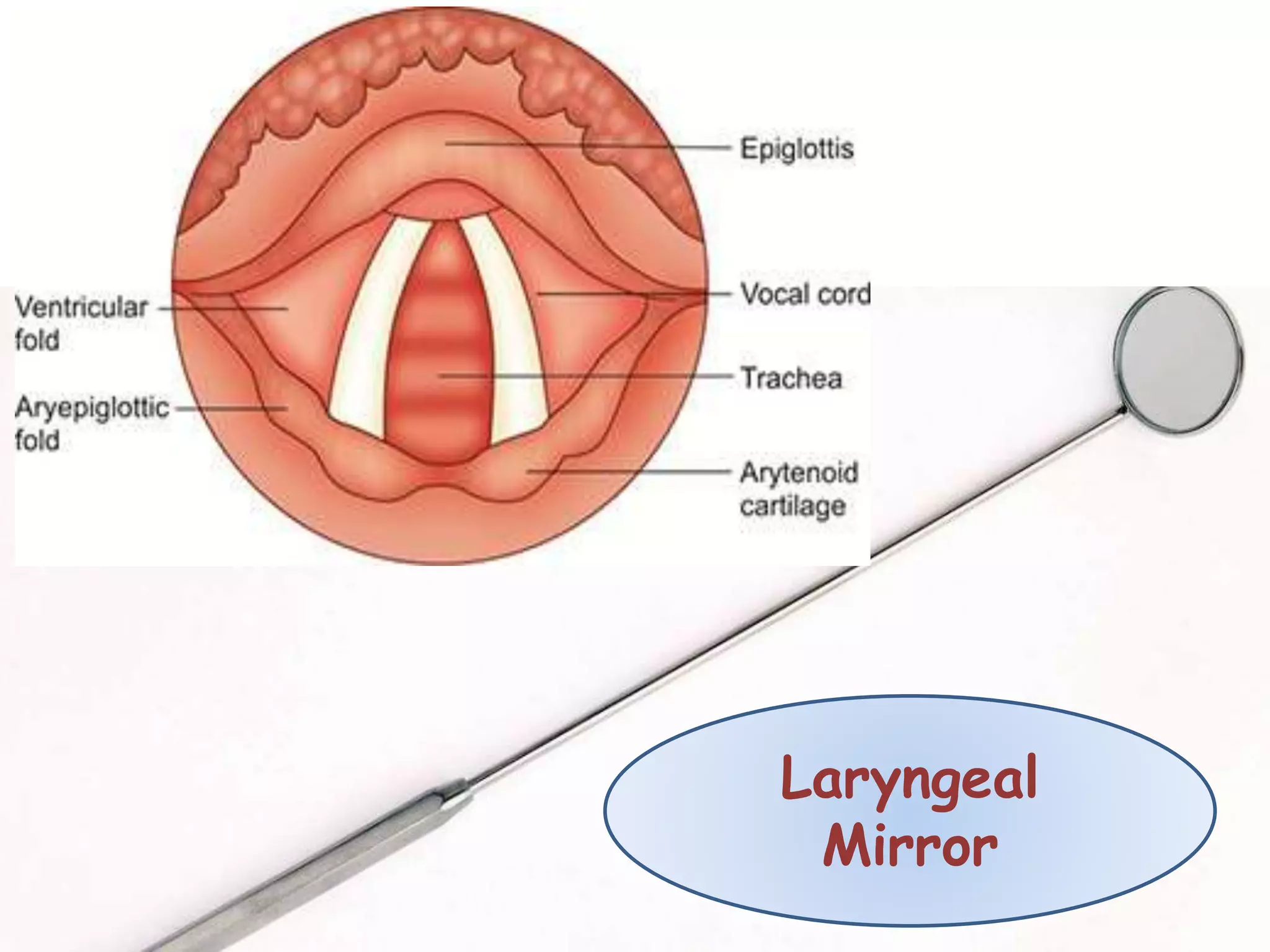 Laryngeal
Mirror
 