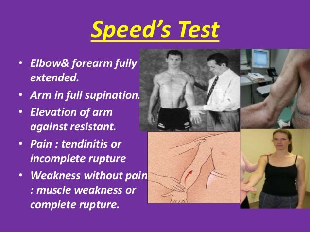 Shoulder Impingement Test shoulder-impingement-test