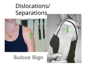 EXAMINATION OF SHOULDER JOINT-1ffff.pptx