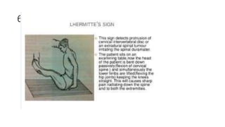 Lahrmets Sign Examination Of Spine and it's patholgies | PPTX