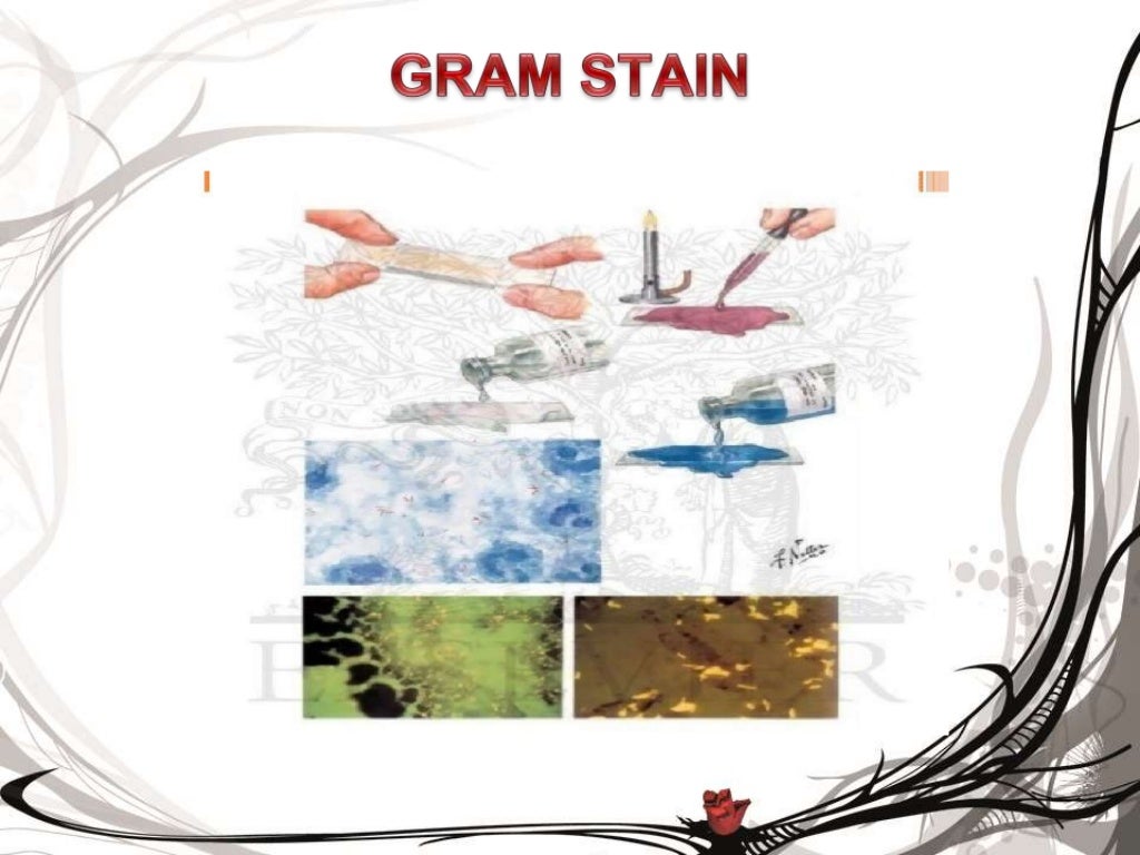 Examination of sputum