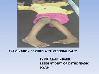 EXAMINATION OF CHILD WITH CEREBRAL PALSY
BY DR. MAULIK PATEL
RESIDENT DEPT. OF ORTHOPEADIC
D.Y.P.H
 