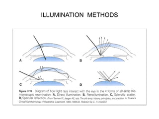 Examination of the cornea by Dr. Iddi Ndyabawe | PPTX
