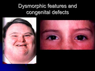 Examination of the eye | PPT