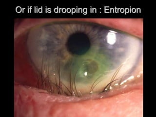 Examination of the eye | PPT