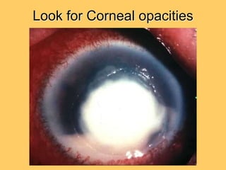 Examination of the eye | PPT