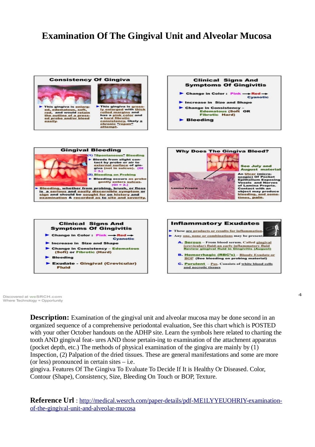 Examination Of The Gingival Unit and Alveolar Mucosa