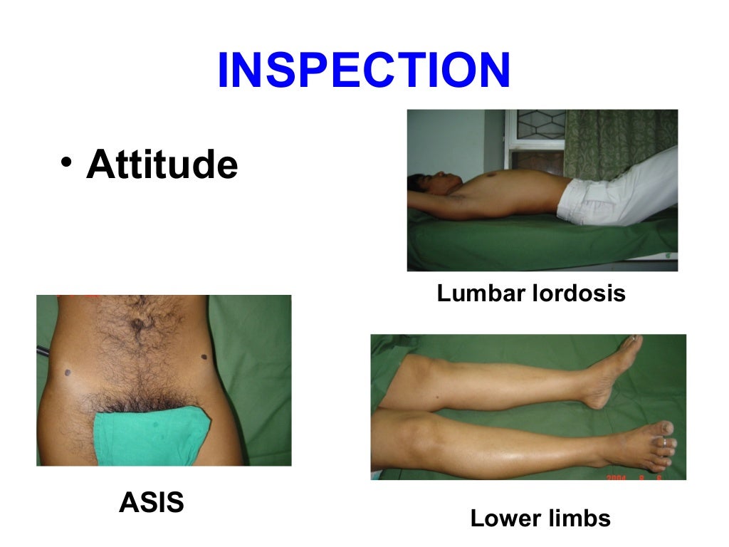 Examination Of The Hip