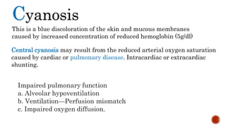 Cyanosis
This is a blue discoloration of the skin and mucous membranes
caused by increased concentration of reduced hemoglobin (5g/dl)
Central cyanosis may result from the reduced arterial oxygen saturation
caused by cardiac or pulmonary disease. Intracardiac or extracardiac
shunting.
Impaired pulmonary function
a. Alveolar hypoventilation
b. Ventilation—Perfusion mismatch
c. Impaired oxygen diffusion.
 