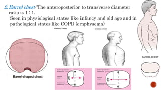 2.Barrel chest: The anteroposterior to transverse diameter
ratio is 1 : 1.
Seen in physiological states like infancy and old age and in
pathological states like COPD (emphysema)
 