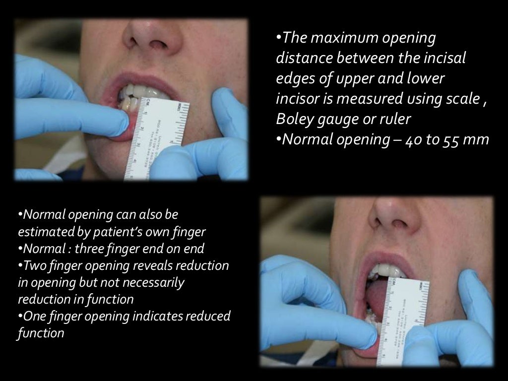 Examination of tmj &muscles of mastication (2)