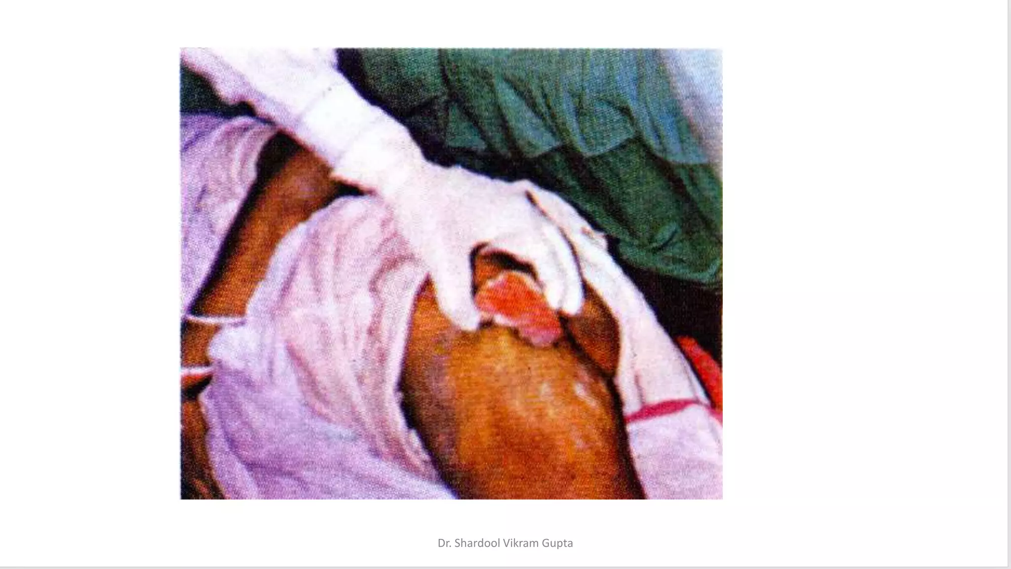 Dr. Shardool Vikram Gupta
 