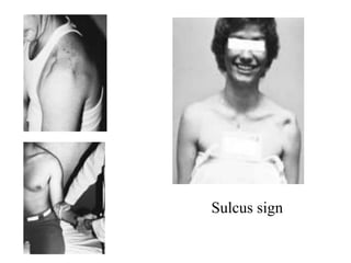 Examination Shoulder (1).pptx