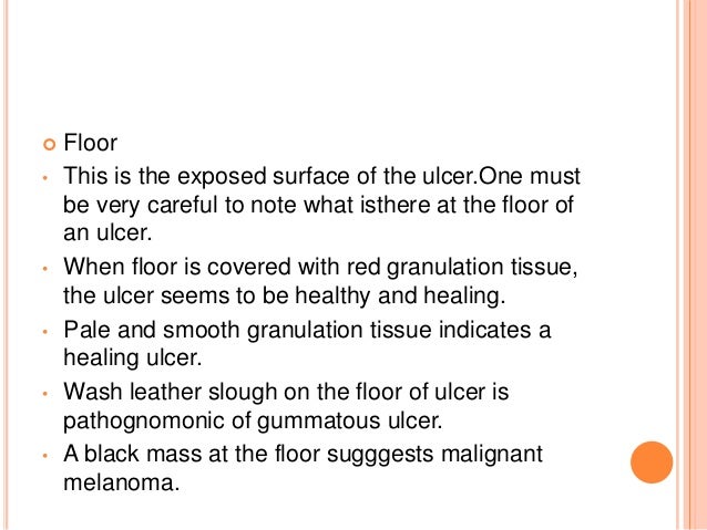 Examinatyion Of Ulcer