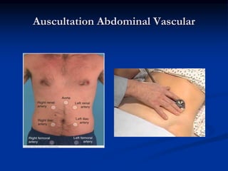 Auscultation Abdominal Vascular
 