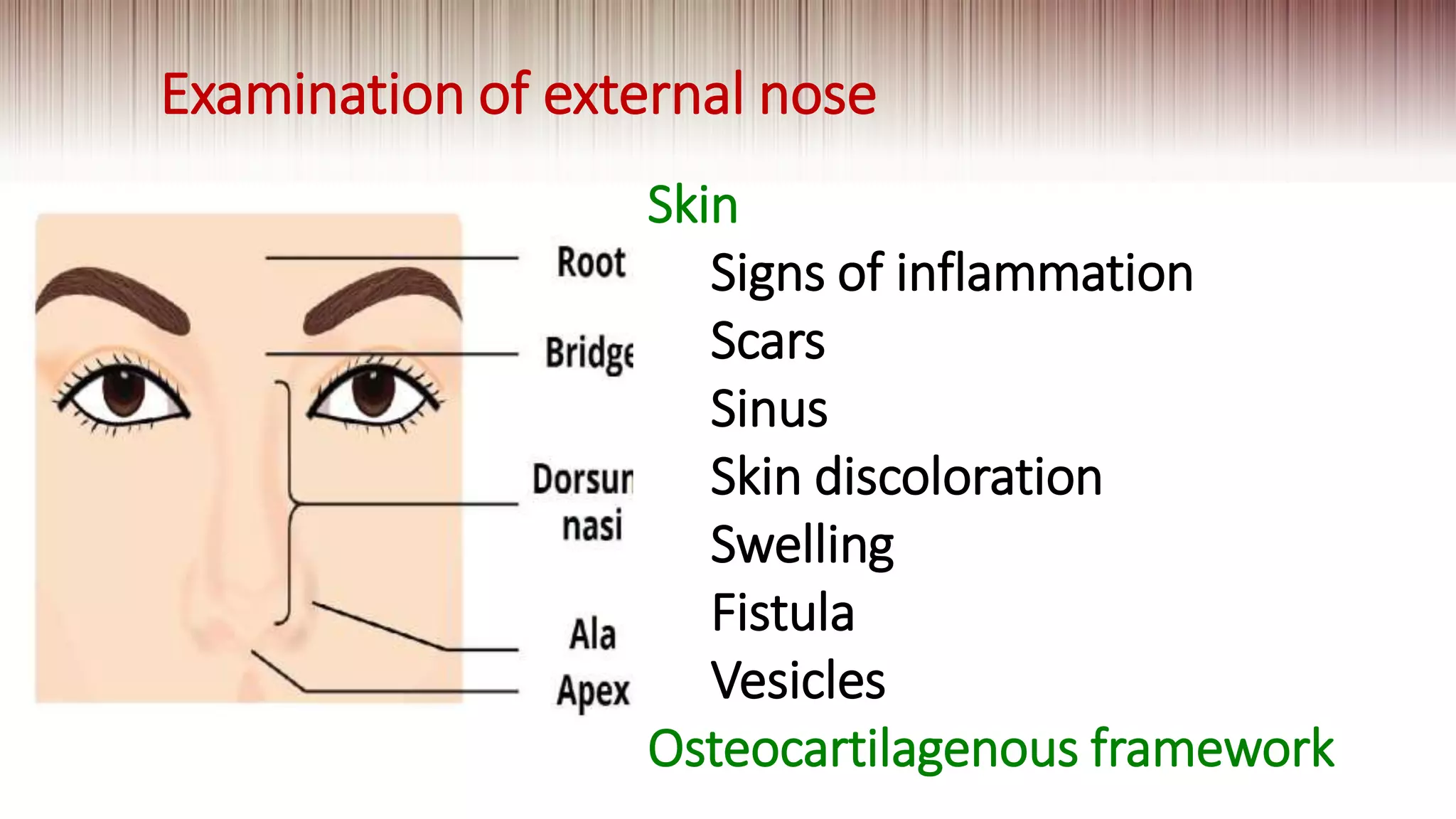 Examination of external nose
Skin
Signs of inflammation
Scars
Sinus
Skin discoloration
Swelling
Fistula
Vesicles
Osteocartilagenous framework
 