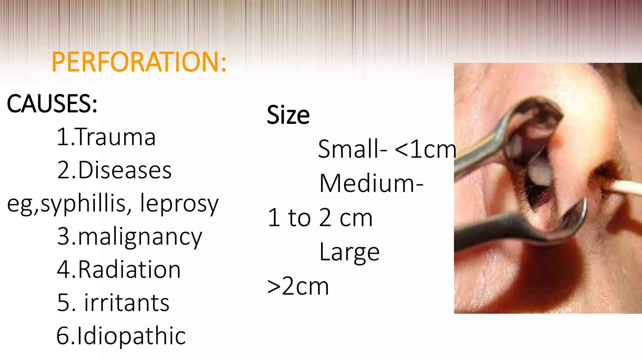 PERFORATION:
CAUSES:
1.Trauma
2.Diseases
eg,syphillis, leprosy
3.malignancy
4.Radiation
5. irritants
6.Idiopathic
Size
Small- <1cm
Medium-
1 to 2 cm
Large
>2cm
 