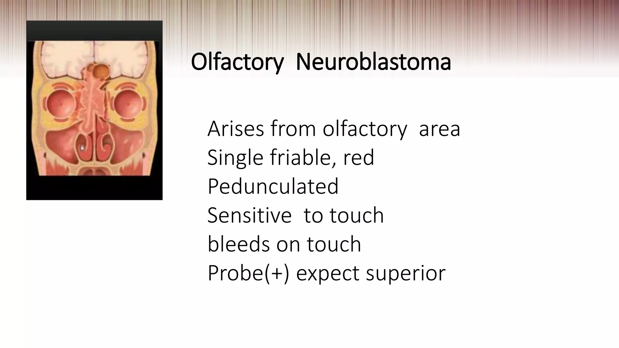 Olfactory Neuroblastoma
Arises from olfactory area
Single friable, red
Pedunculated
Sensitive to touch
bleeds on touch
Probe(+) expect superior
 