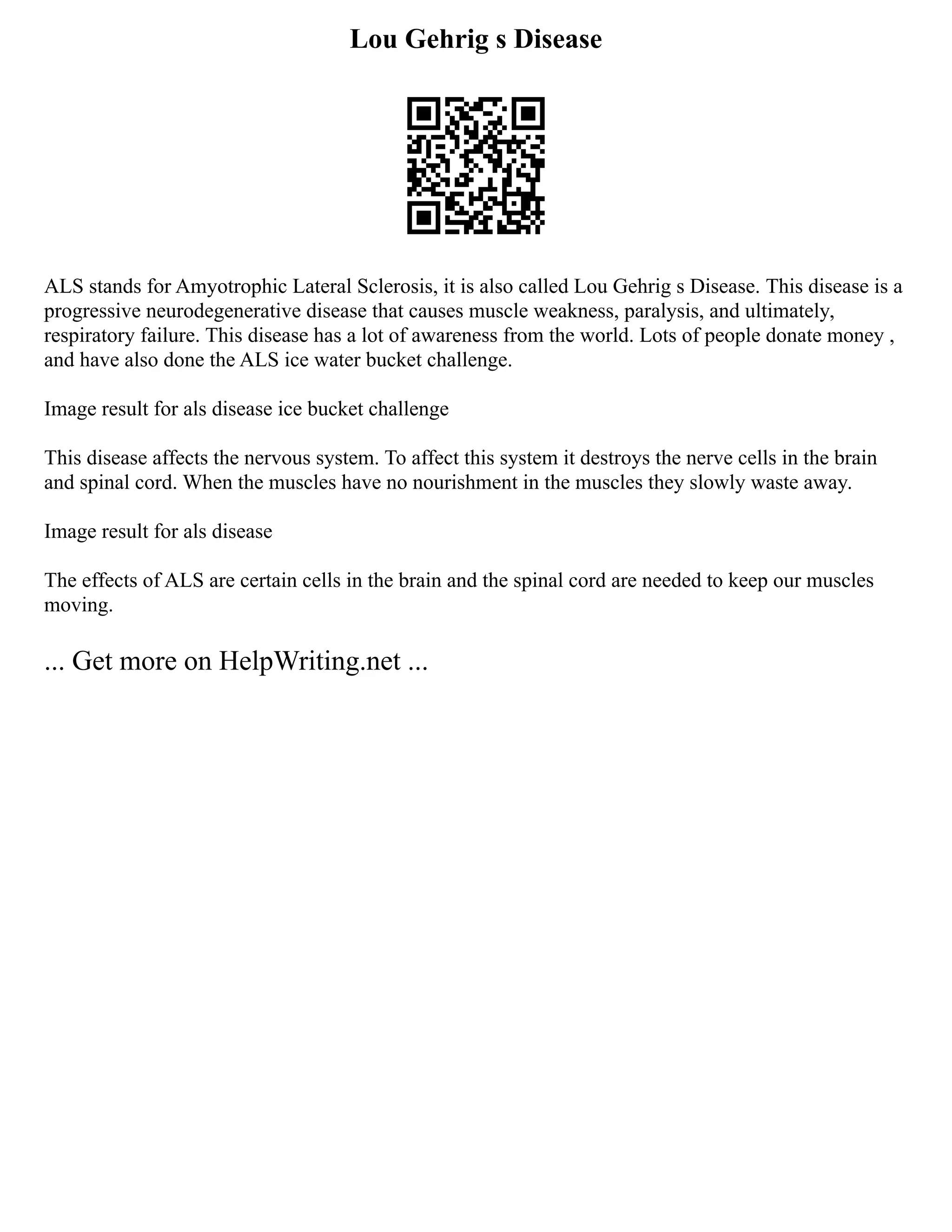 Lou Gehrig s Disease
ALS stands for Amyotrophic Lateral Sclerosis, it is also called Lou Gehrig s Disease. This disease is a
progressive neurodegenerative disease that causes muscle weakness, paralysis, and ultimately,
respiratory failure. This disease has a lot of awareness from the world. Lots of people donate money ,
and have also done the ALS ice water bucket challenge.
Image result for als disease ice bucket challenge
This disease affects the nervous system. To affect this system it destroys the nerve cells in the brain
and spinal cord. When the muscles have no nourishment in the muscles they slowly waste away.
Image result for als disease
The effects of ALS are certain cells in the brain and the spinal cord are needed to keep our muscles
moving.
... Get more on HelpWriting.net ...
 