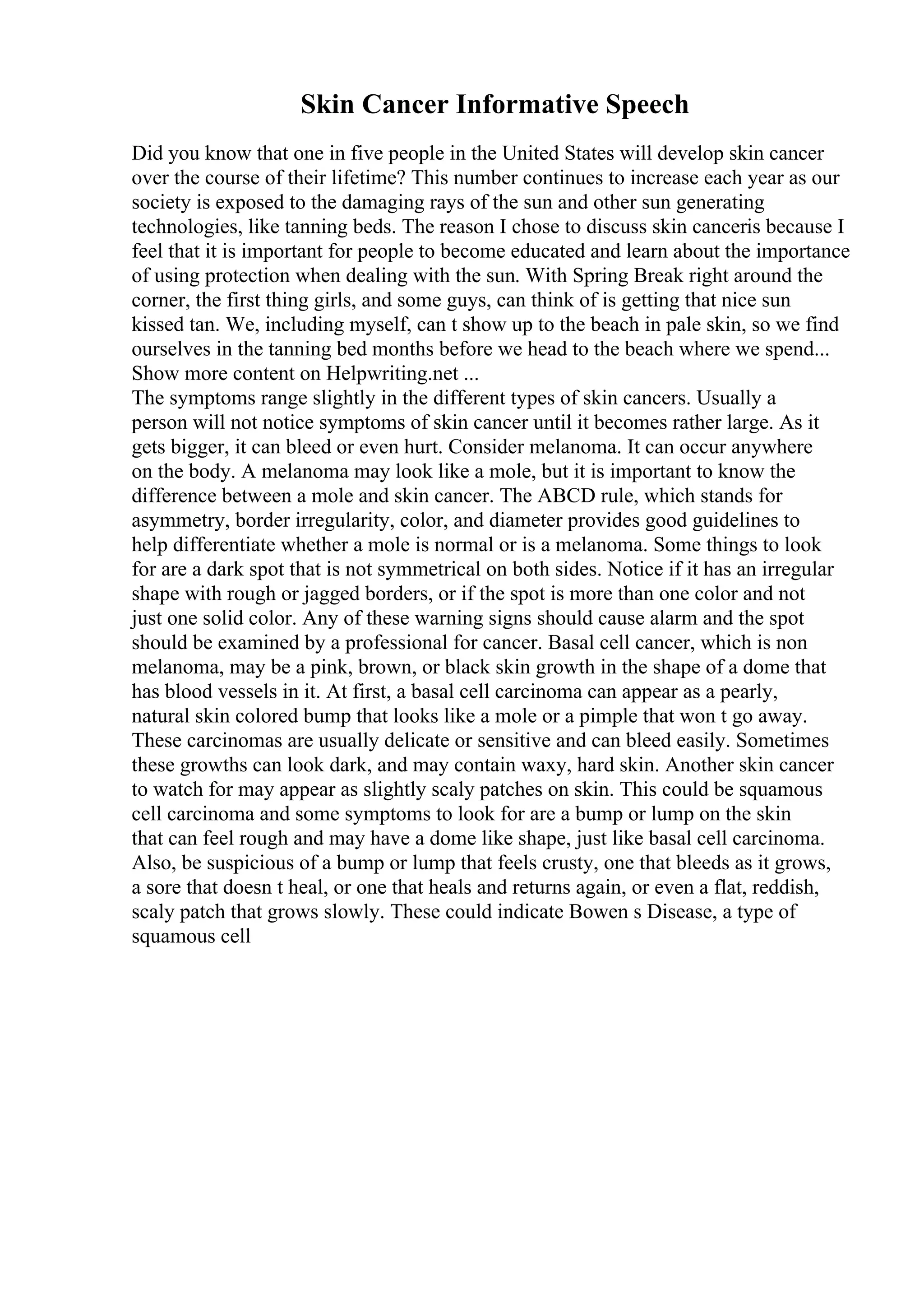 Example Of A Narrative Essay Pdf