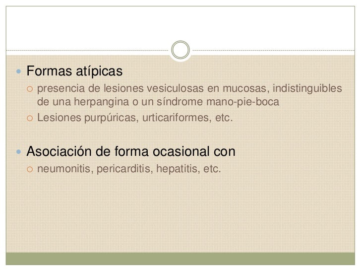 Exantema De Boston Coxsackie Echo9 Y 11 Enterovirus