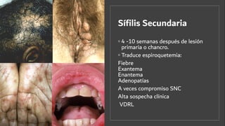Síﬁlis Secundaria
◦ 4 -10 semanas después de lesión
primaria o chancro.
◦ Traduce espiroquetemia:
Fiebre
Exantema
Enantema
Adenopatías
A veces compromiso SNC
Alta sospecha clínica
VDRL
 
