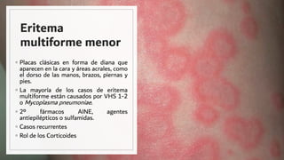 Eritema
multiforme menor
◦ Placas clásicas en forma de diana que
aparecen en la cara y áreas acrales, como
el dorso de las manos, brazos, piernas y
pies.
◦ La mayoría de los casos de eritema
multiforme están causados por VHS 1-2
o Mycoplasma pneumoniae.
◦ 2º fármacos AINE, agentes
antiepilépticos o sulfamidas.
◦ Casos recurrentes
◦ Rol de los Corticoides
 